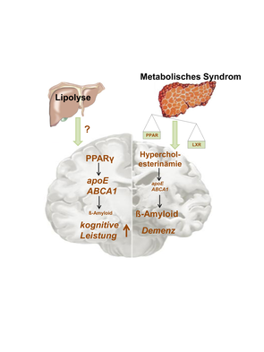 Grafik mehrerer Körperteile, die vom metabolischen Syndrom betroffen sind
